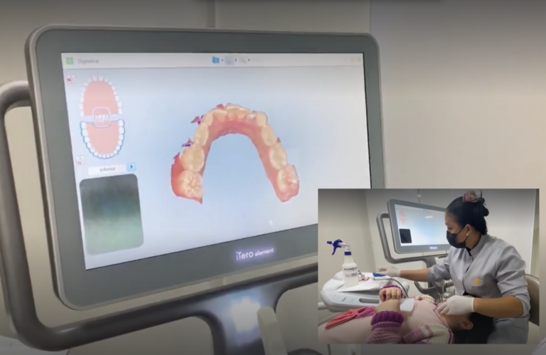Escaneamento intraoral em ortodontia digital