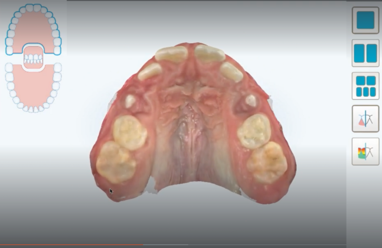 Solicitação do expansor ao laboratório